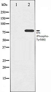 ETk (Phospho-Tyr566) antibody