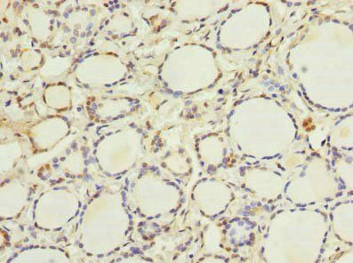 ETNK1 Antibody