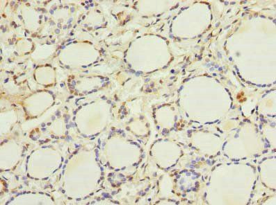 ETNK1 antibody