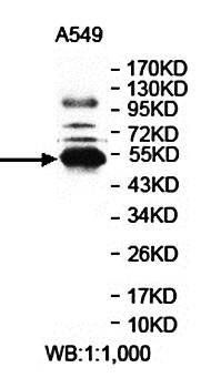 ETNK1 antibody