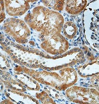 ETNK2 Rabbit Polyclonal Antibody