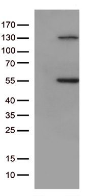 ETS1 associated protein II (TDP2) antibody