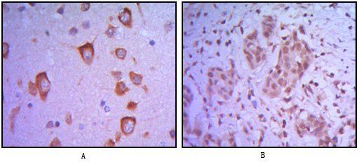 ETS1 Antibody