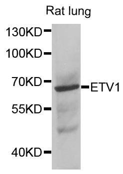 ETV1 antibody