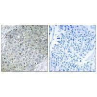 ETV4 antibody