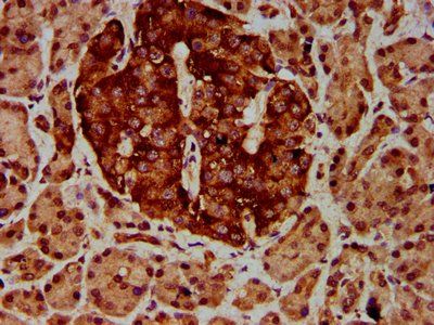 ETV5 Antibody