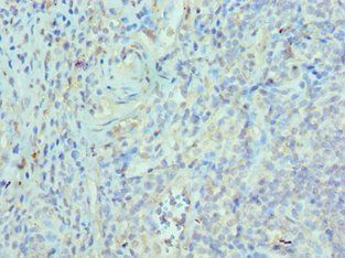 ETV6 Antibody