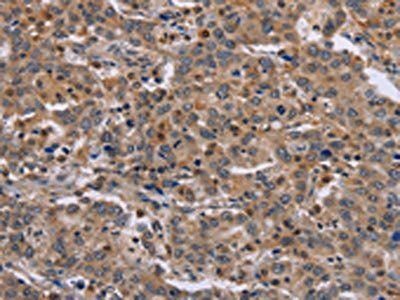 ETV7 Antibody