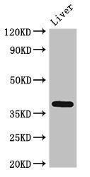 ETV7 antibody