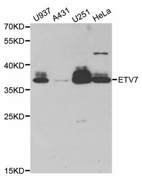 ETV7 antibody