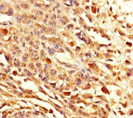 Eukaryotic initiation factor 4A-II antibody