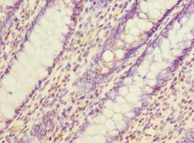 EVA1C Antibody