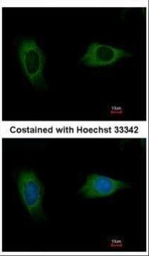 EVC2 antibody