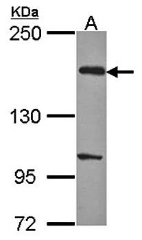 EVC2 antibody