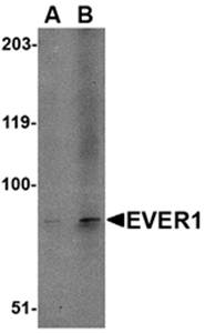 EVER1 Antibody