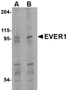 EVER1 Antibody