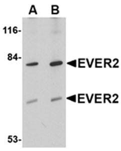 EVER2 Antibody