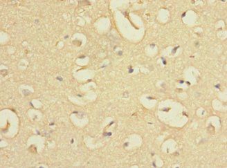 EVI2A Antibody