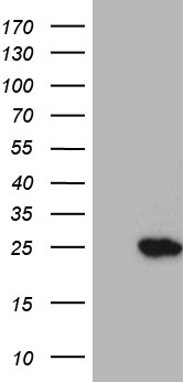 EVX1 antibody