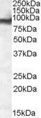 Goat anti-EWS / EWSR1 Antibody