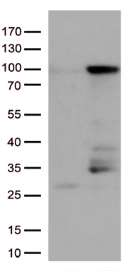 EWSR1 antibody