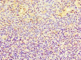 EWSR1 Antibody
