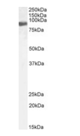 Goat anti-EWS / EWSR1, Biotinylated Antibody