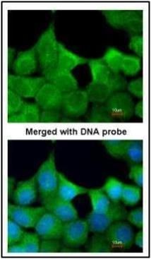 EXOC7 antibody