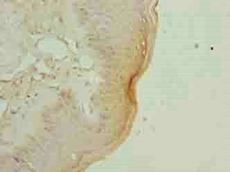 EXOSC1 Antibody