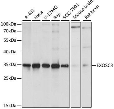 EXOSC3 antibody