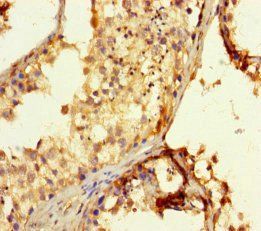 EXOSC3 Antibody
