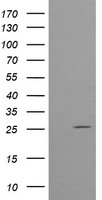 EXOSC7 antibody