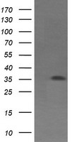 EXOSC7 Antibody