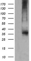 EXOSC7 antibody