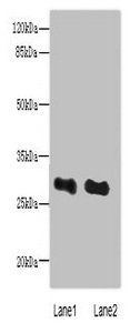 EXOSC8 Antibody