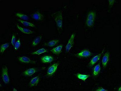 Exostosin-like 3 antibody