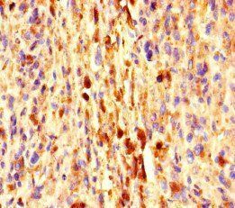 EXPH5 Antibody