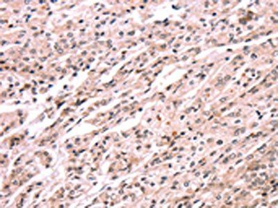 EXTL1 Antibody