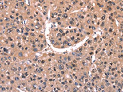 EXTL1 Antibody