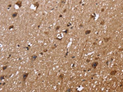 EXTL3 Antibody