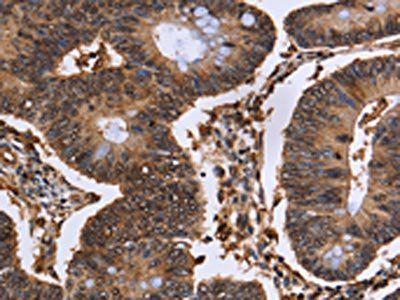 EXTL3 Antibody