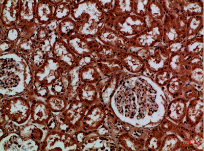 EYA1/EYA4 Antibody