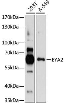 EYA2 antibody