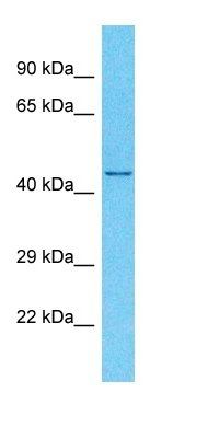EYA4 antibody