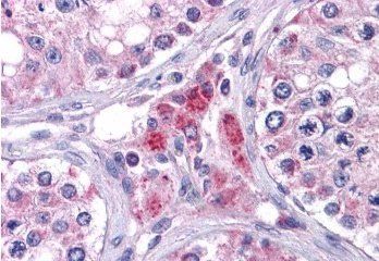 Goat anti-EYA4 Antibody