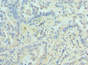 EZH1 antibody