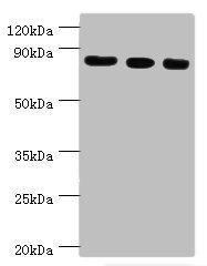 EZH2 antibody