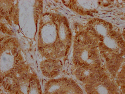 EZH2 Recombinant Monoclonal Antibody