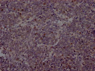 EZH2 Recombinant Monoclonal Antibody