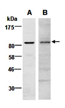 EZH2 antibody